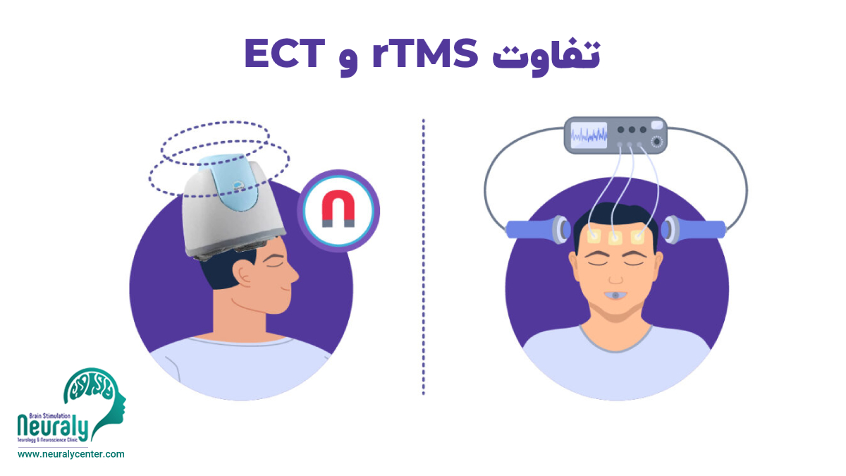 تفاوت rTMS و ECT